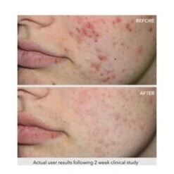 QuasarMD Clear Rayz - White 7 QuasarMD Clear Rayz - White -Skin Care Shop Clear Rayz White add3 34621 3948 general