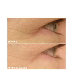 Dr Dennis Gross DRx SpectraLite EyeCare Max Pro 8 Dr Dennis Gross DRx SpectraLite EyeCare Max Pro - Image 6