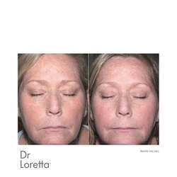 Dr Loretta Intense Brightening Cream 5 Dr Loretta Intense Brightening Cream - Image 3