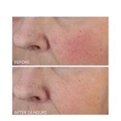 Dr Dennis Gross Vitamin C + Lactic Dewy Deep Cream 9 Dr Dennis Gross Vitamin C + Lactic Dewy Deep Cream -Skin Care Shop Vitamin C Lactic Dewy Deep Cream add3 68793 6217 general